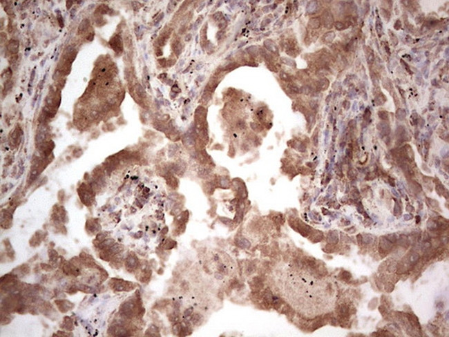 RET Antibody in Immunohistochemistry (Paraffin) (IHC (P))