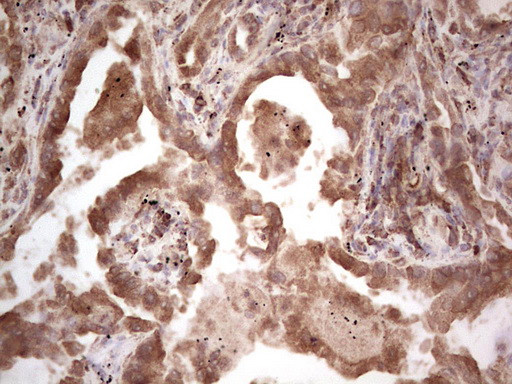 RET Antibody in Immunohistochemistry (Paraffin) (IHC (P))