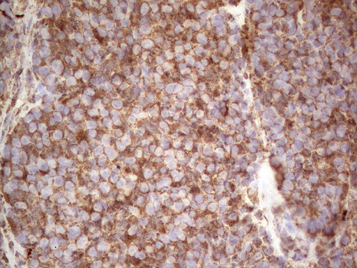 RET Antibody in Immunohistochemistry (Paraffin) (IHC (P))