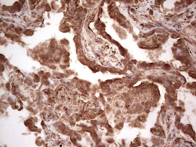 RET Antibody in Immunohistochemistry (Paraffin) (IHC (P))
