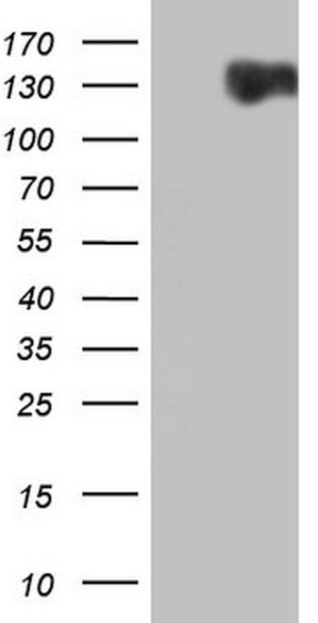 RET Antibody in Western Blot (WB)