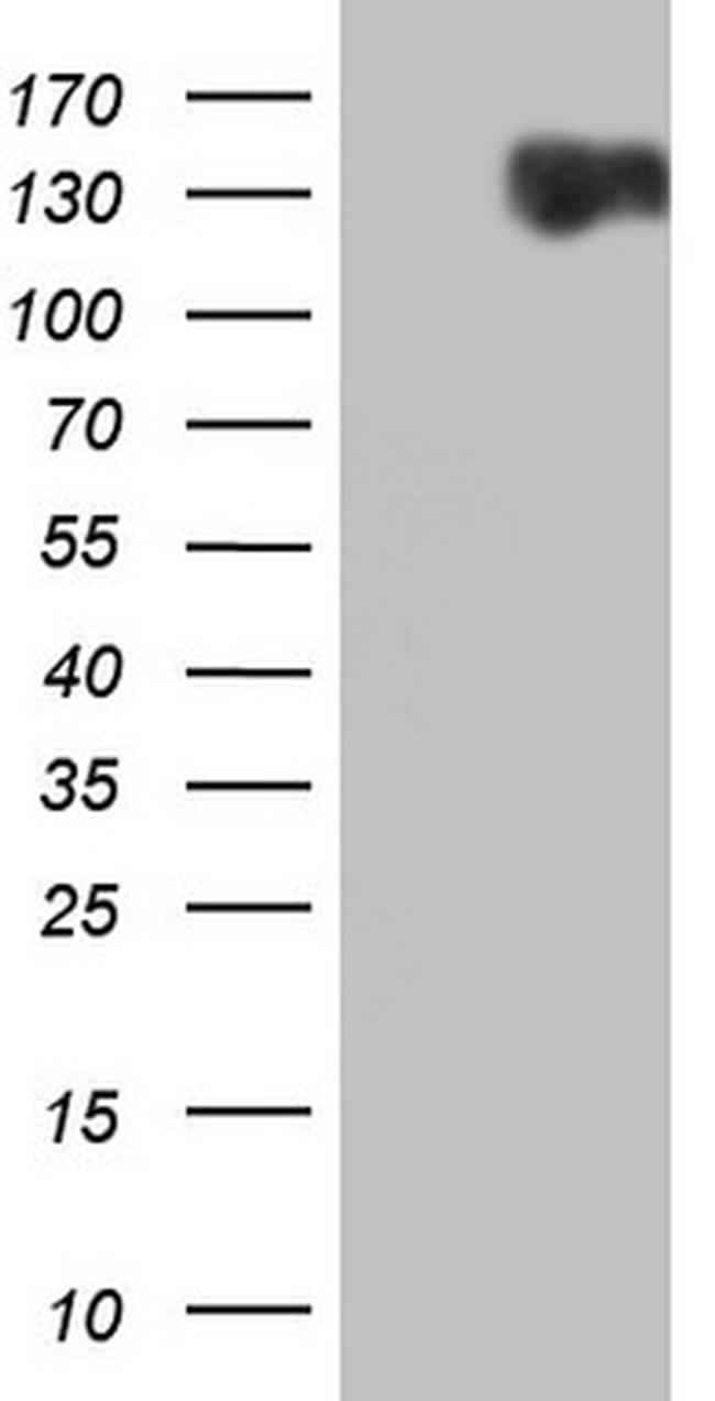 RET Antibody in Western Blot (WB)