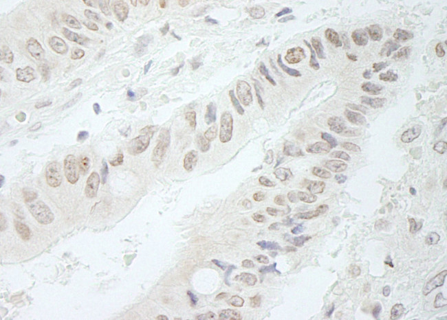 RFC3 Antibody in Immunohistochemistry (IHC)