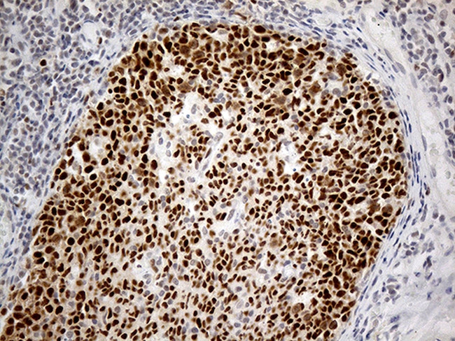 RFC3 Antibody in Immunohistochemistry (Paraffin) (IHC (P))