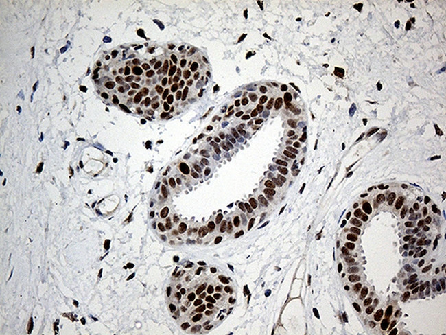 RFC3 Antibody in Immunohistochemistry (Paraffin) (IHC (P))