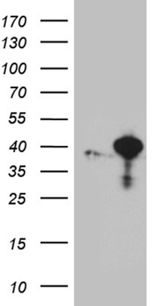 RFC3 Antibody in Western Blot (WB)