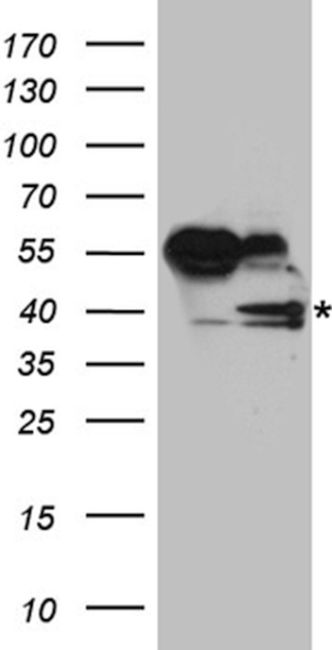 RFC3 Antibody in Western Blot (WB)