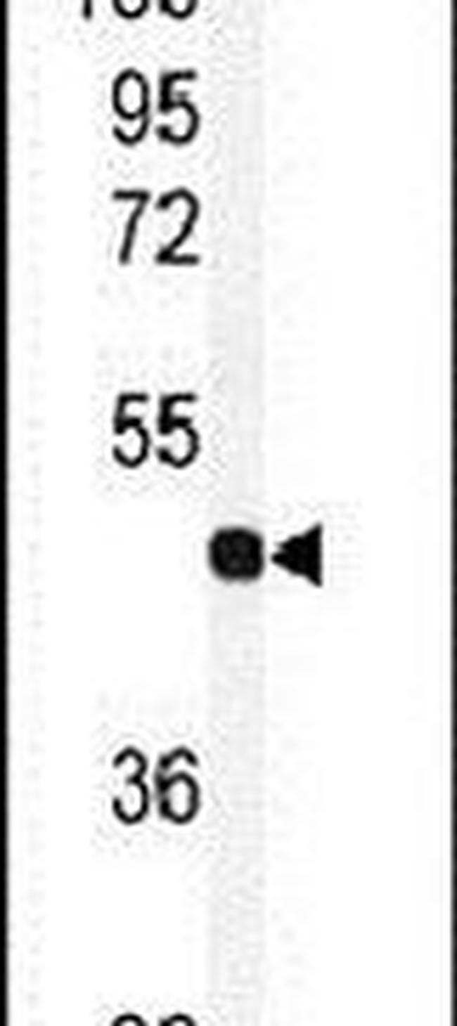 RFC3 Antibody in Western Blot (WB)