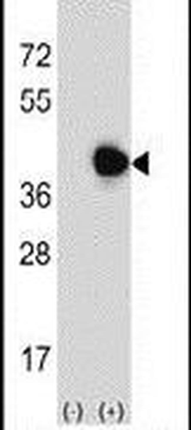 RFC5 Antibody in Western Blot (WB)