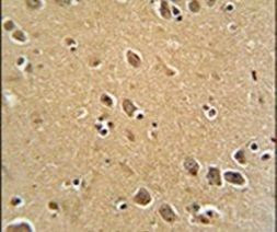 RFT1 Antibody in Immunohistochemistry (IHC)