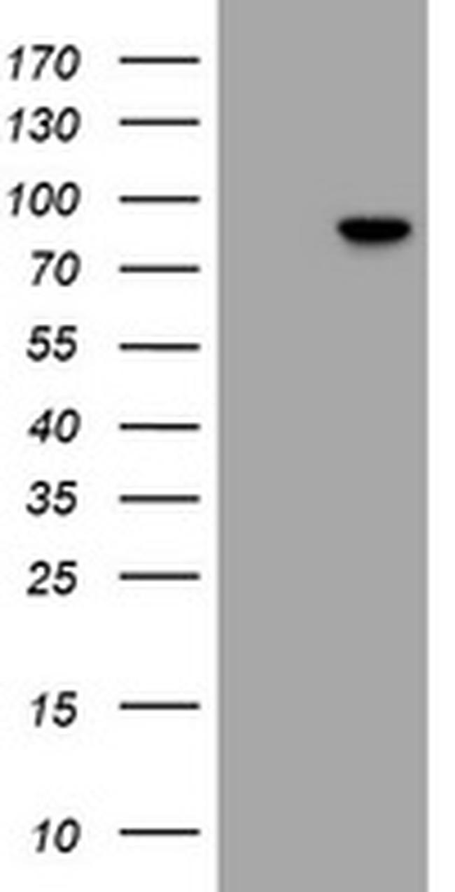 RFX3 Antibody in Western Blot (WB)