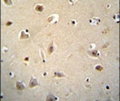 RGAG4 Antibody in Immunohistochemistry (IHC)
