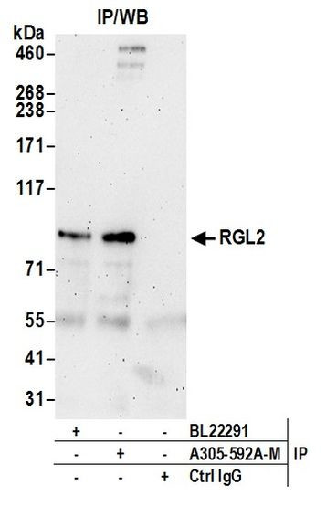 RGL2 Antibody in Immunoprecipitation (IP)