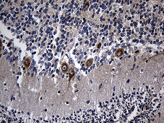 RGMA Antibody in Immunohistochemistry (Paraffin) (IHC (P))