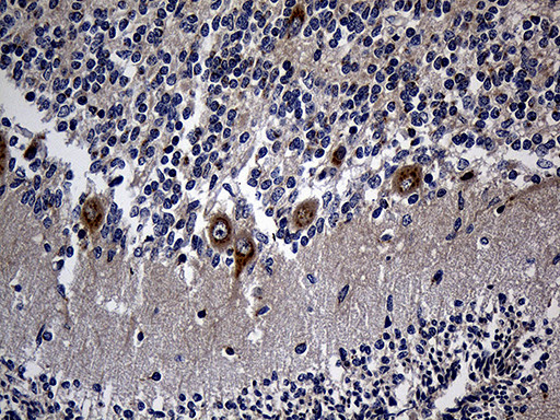 RGMA Antibody in Immunohistochemistry (Paraffin) (IHC (P))