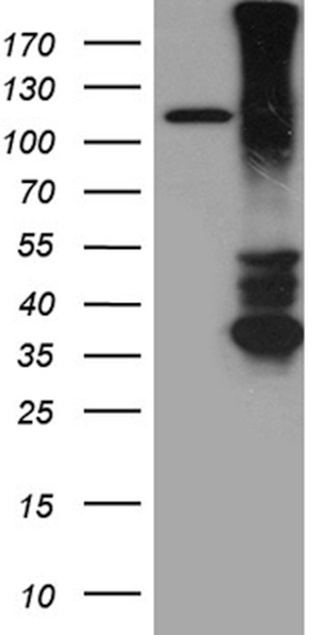 RGMA Antibody in Western Blot (WB)