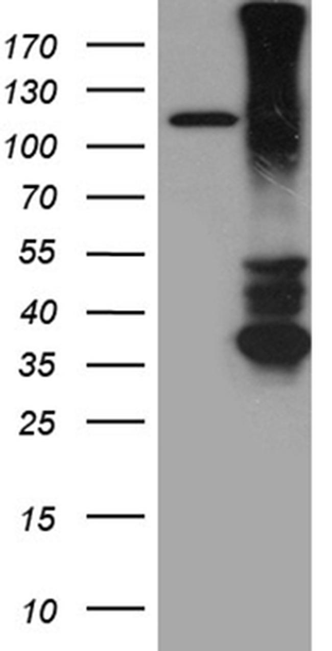 RGMA Antibody in Western Blot (WB)