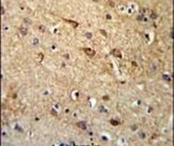 RGR Antibody in Immunohistochemistry (IHC)
