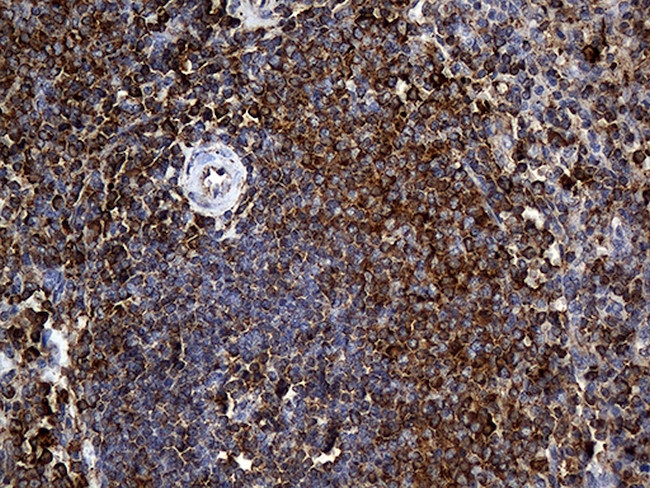 RGS10 Antibody in Immunohistochemistry (Paraffin) (IHC (P))