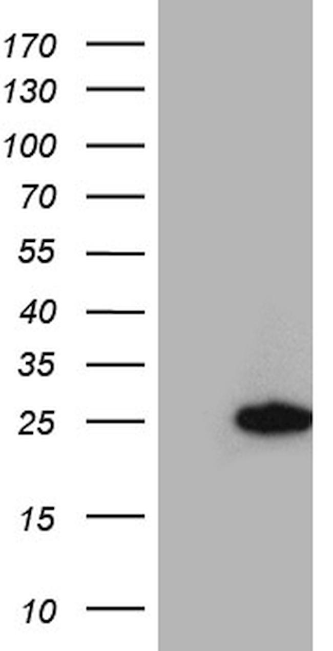 RGS10 Antibody in Western Blot (WB)