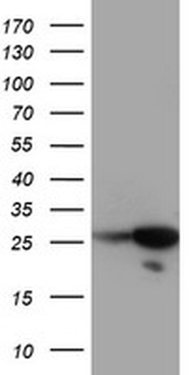 RGS16 Antibody in Western Blot (WB)
