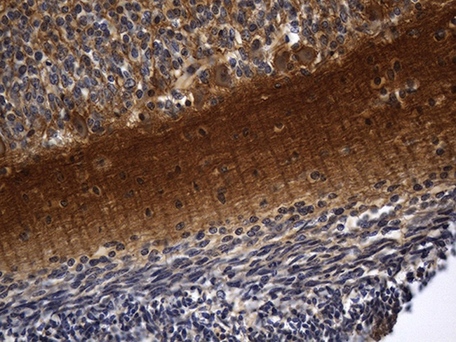 RGS17 Antibody in Immunohistochemistry (Paraffin) (IHC (P))