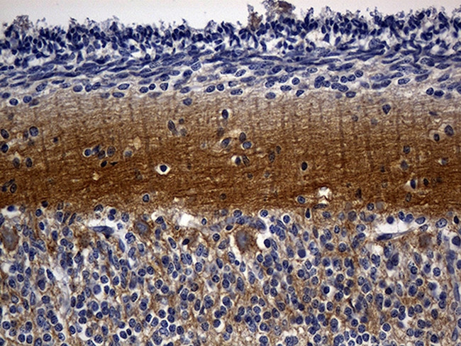RGS17 Antibody in Immunohistochemistry (Paraffin) (IHC (P))