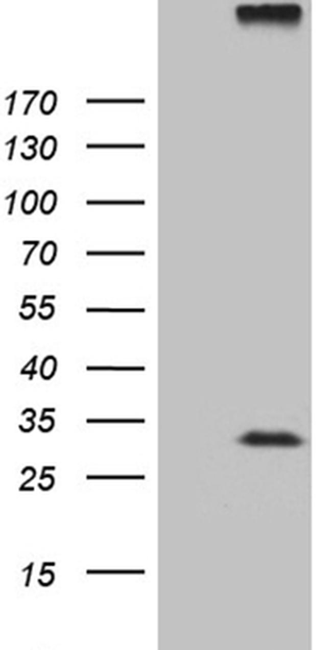 RGS17 Antibody in Western Blot (WB)