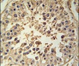 RGS22 Antibody in Immunohistochemistry (IHC)