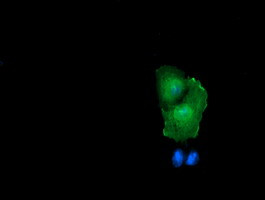 RHOJ Antibody in Immunocytochemistry (ICC/IF)