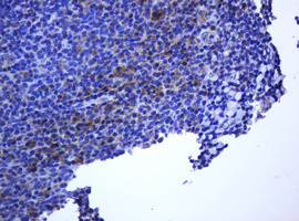 RHOJ Antibody in Immunohistochemistry (Paraffin) (IHC (P))