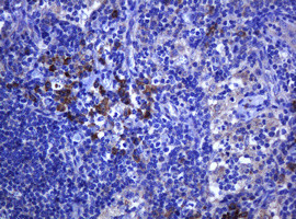 RHOJ Antibody in Immunohistochemistry (Paraffin) (IHC (P))
