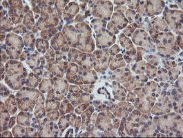 RHOJ Antibody in Immunohistochemistry (Paraffin) (IHC (P))