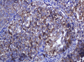 RHOJ Antibody in Immunohistochemistry (Paraffin) (IHC (P))