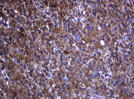 RHOJ Antibody in Immunohistochemistry (Paraffin) (IHC (P))