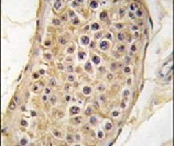 RICTOR Antibody in Immunohistochemistry (IHC)