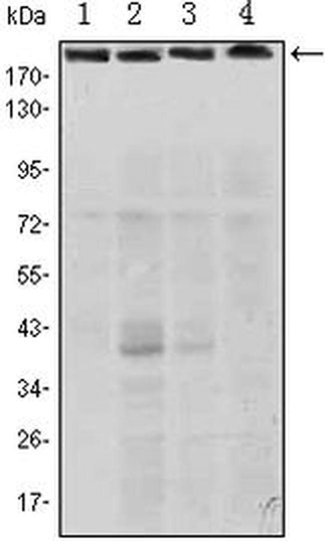 RICTOR Antibody in Western Blot (WB)