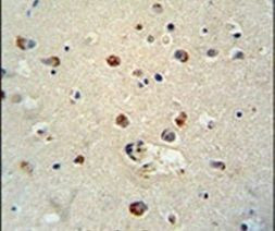 RILPL1 Antibody in Immunohistochemistry (IHC)