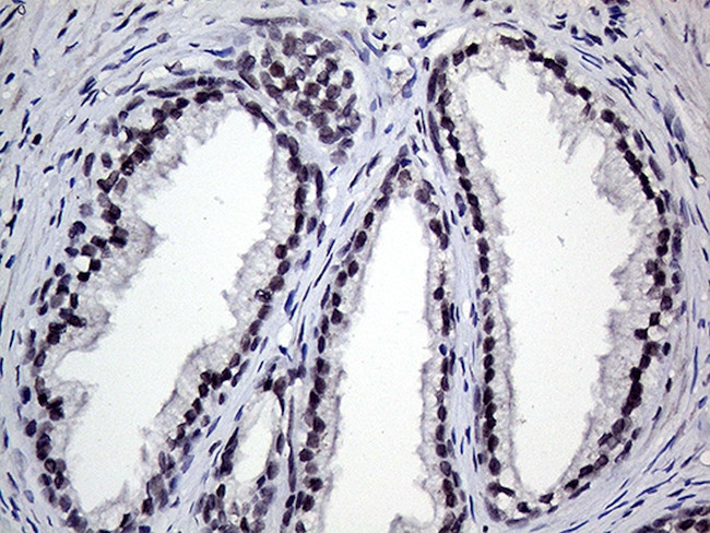 RING1 Antibody in Immunohistochemistry (Paraffin) (IHC (P))