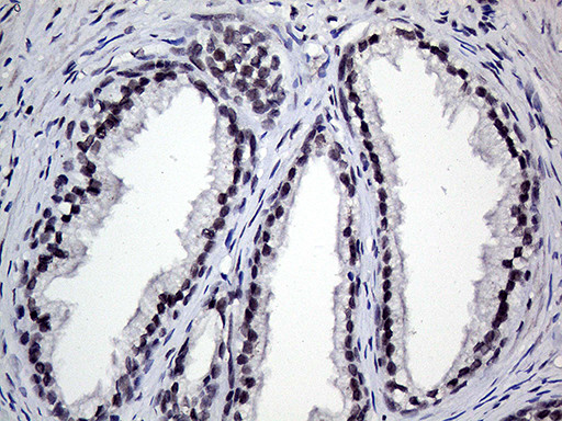 RING1 Antibody in Immunohistochemistry (Paraffin) (IHC (P))