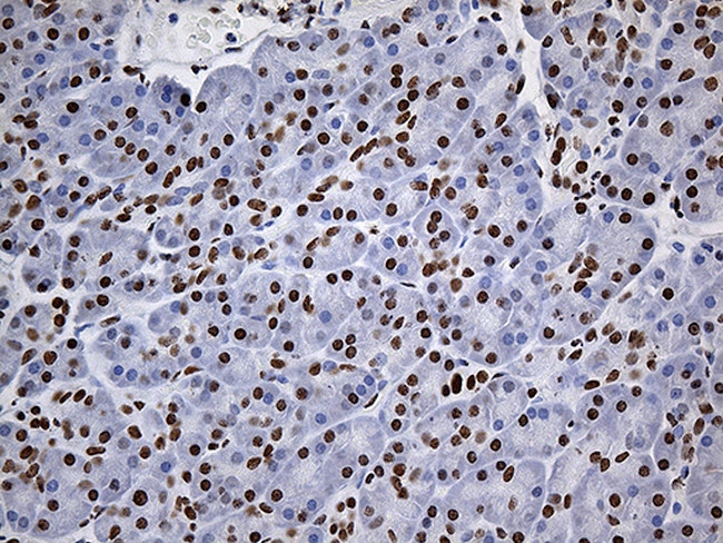 RING1 Antibody in Immunohistochemistry (Paraffin) (IHC (P))