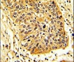 RIOK1 Antibody in Immunohistochemistry (IHC)