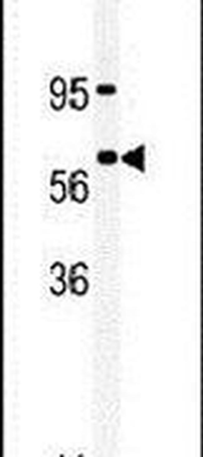 RIOK1 Antibody in Western Blot (WB)