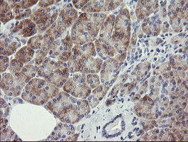 RIOK2 Antibody in Immunohistochemistry (Paraffin) (IHC (P))