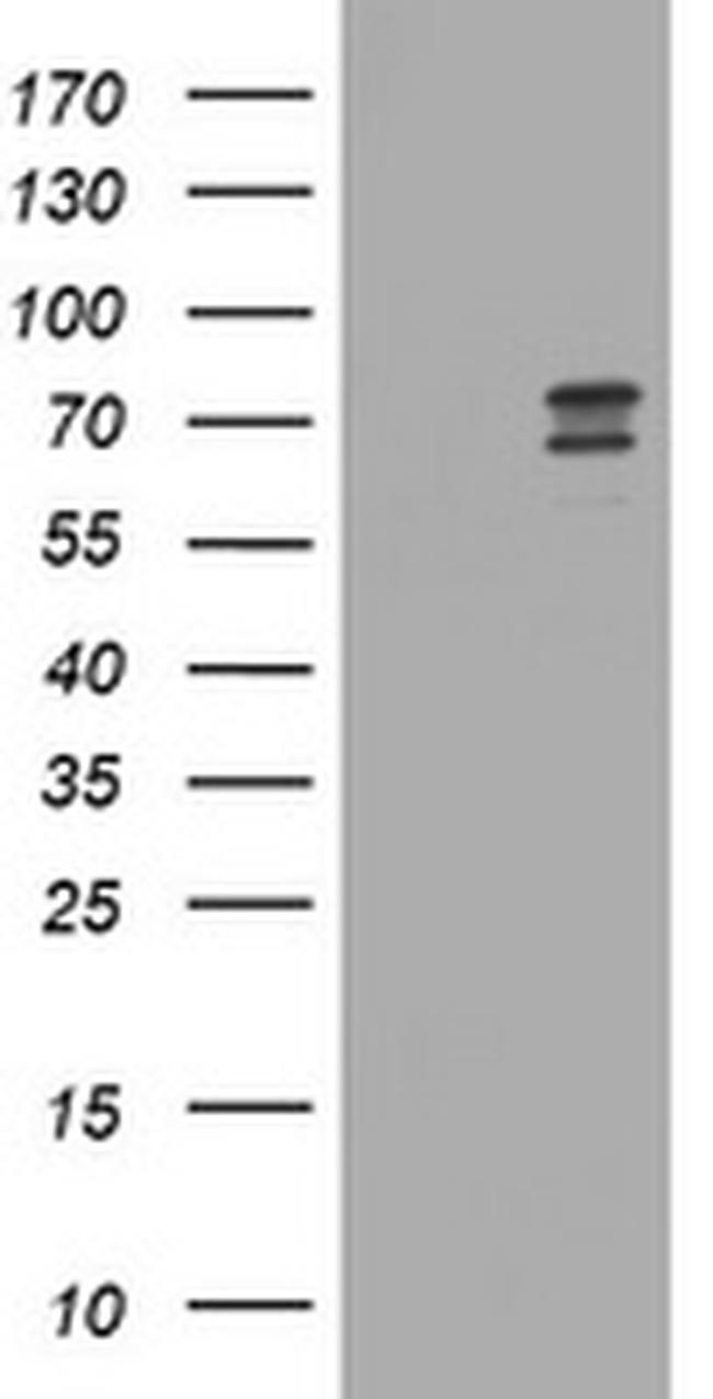 RIOK2 Antibody in Western Blot (WB)