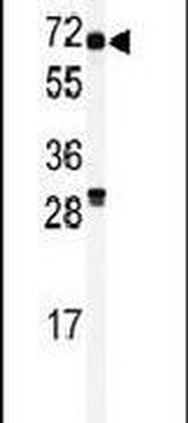 RIOK2 Antibody in Western Blot (WB)