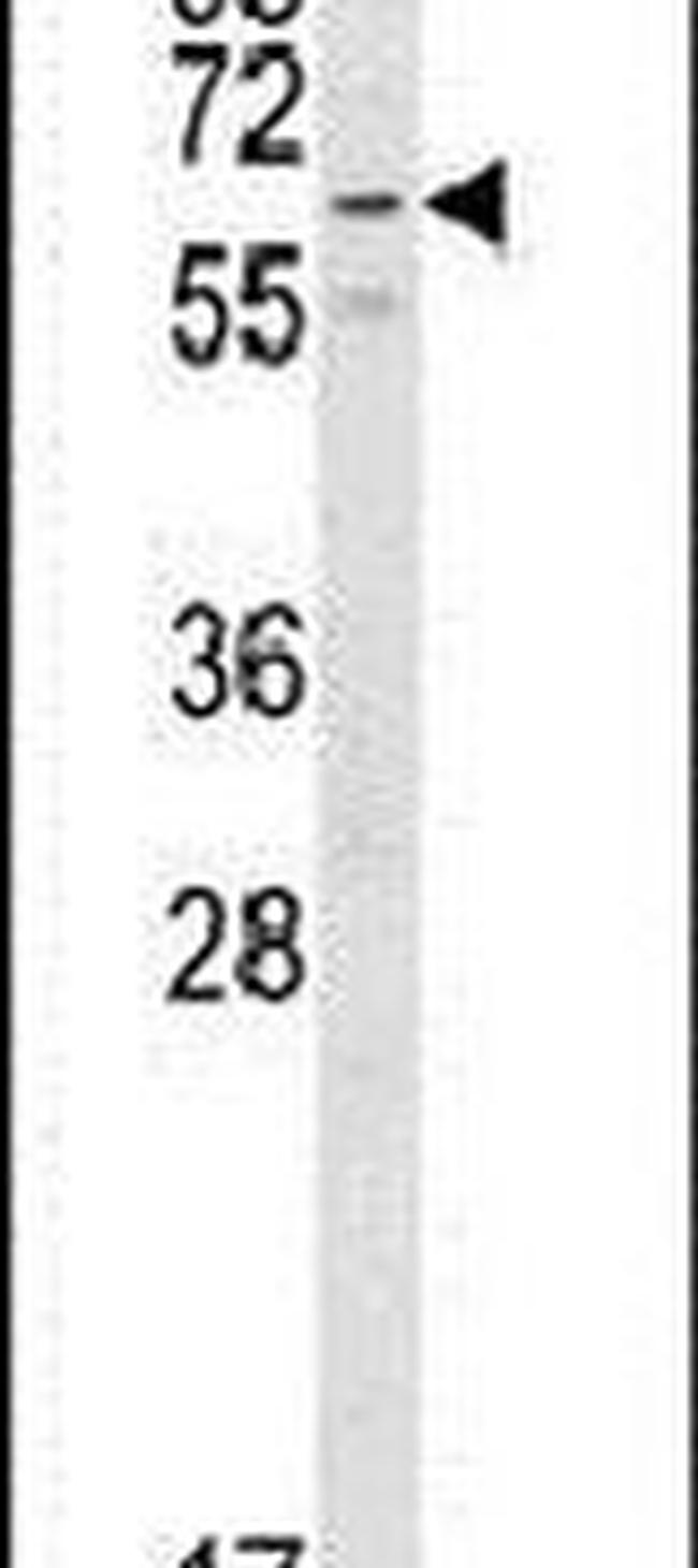 RIOK2 Antibody in Western Blot (WB)