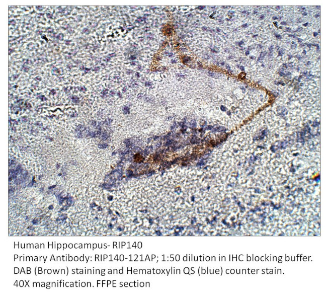 RIP140 Antibody in Immunohistochemistry (IHC)