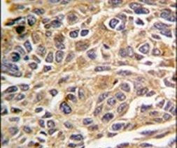 RIP3 Antibody in Immunohistochemistry (IHC)