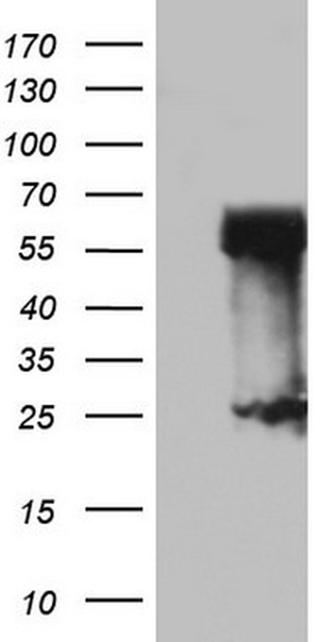RIPK3 Antibody in Western Blot (WB)